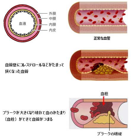 血管イメージ