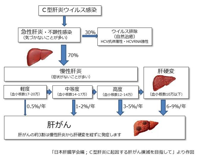 肝炎とは B型肝炎とc型肝炎 北九州市の内科 肝臓内科なら かじわらクリニック